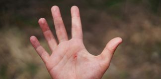 Un polițist din București a fost mușcat de mână în timp ce încătușa un bărbat beat. Ce s-a întâmplat apoi la Obregia person in black leather strap watch showing left palm
